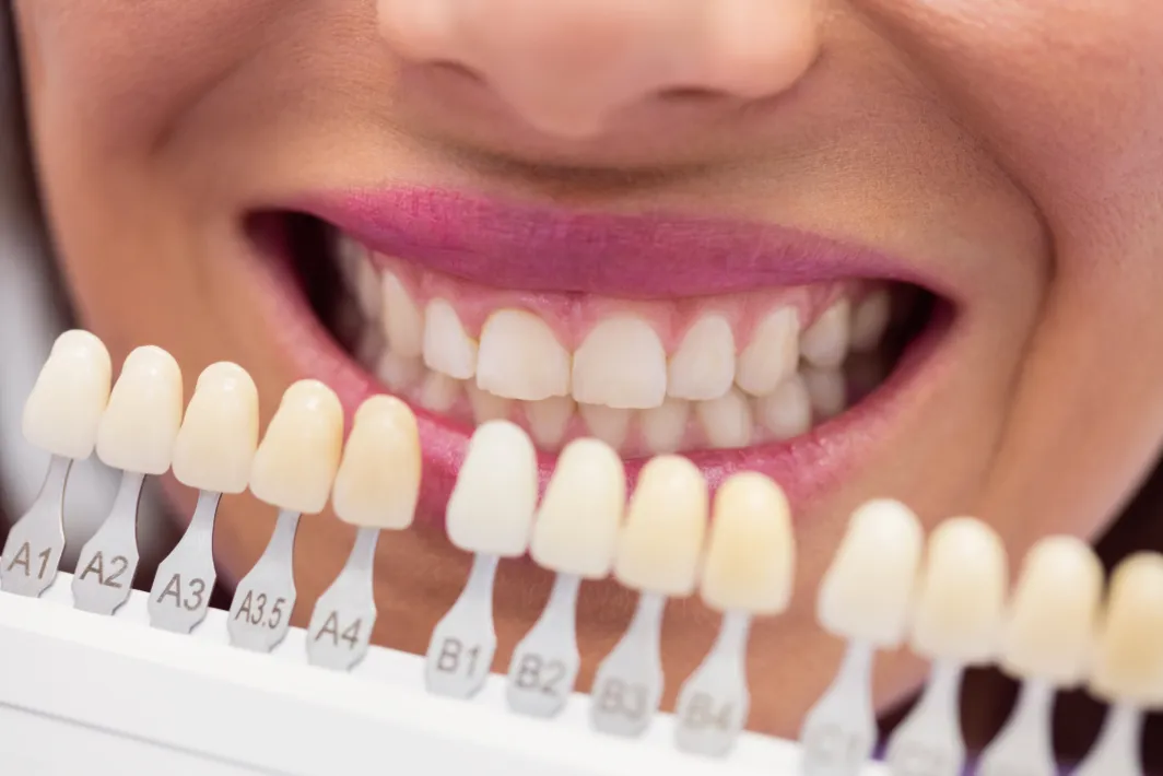 Zirkonyum mu? Porselen mi? Gülüş Tasarımında Hangi Materyal Daha Uygun?