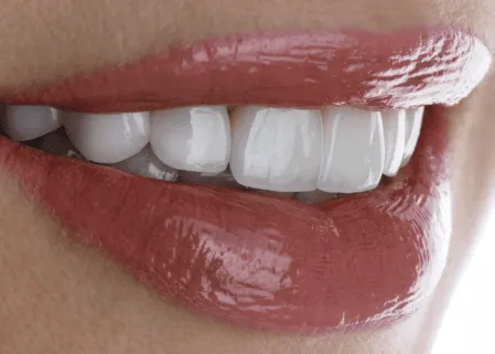 İmplantlar ve Sanatçılar: Sahnedeki Gülüşün Hikayesi